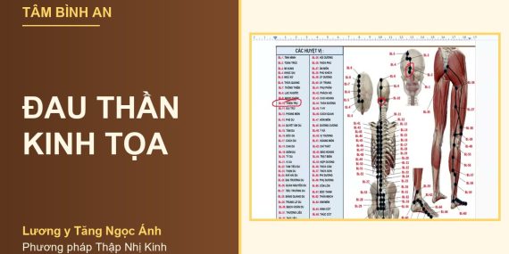 Đau thần kinh tọa - Lương y Tăng Ngọc Ánh, phương pháp Thập Nhị Kinh
