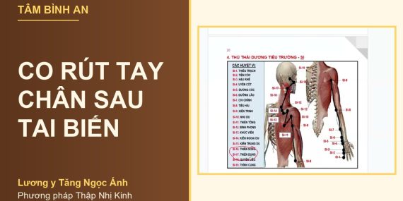 Co rút tay chân sau tai biến - Lương y Tăng Ngọc Ánh, phương pháp Thập Nhị Kinh