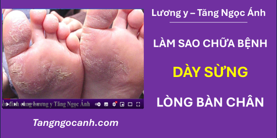 chữa da lòng bàn chân dày