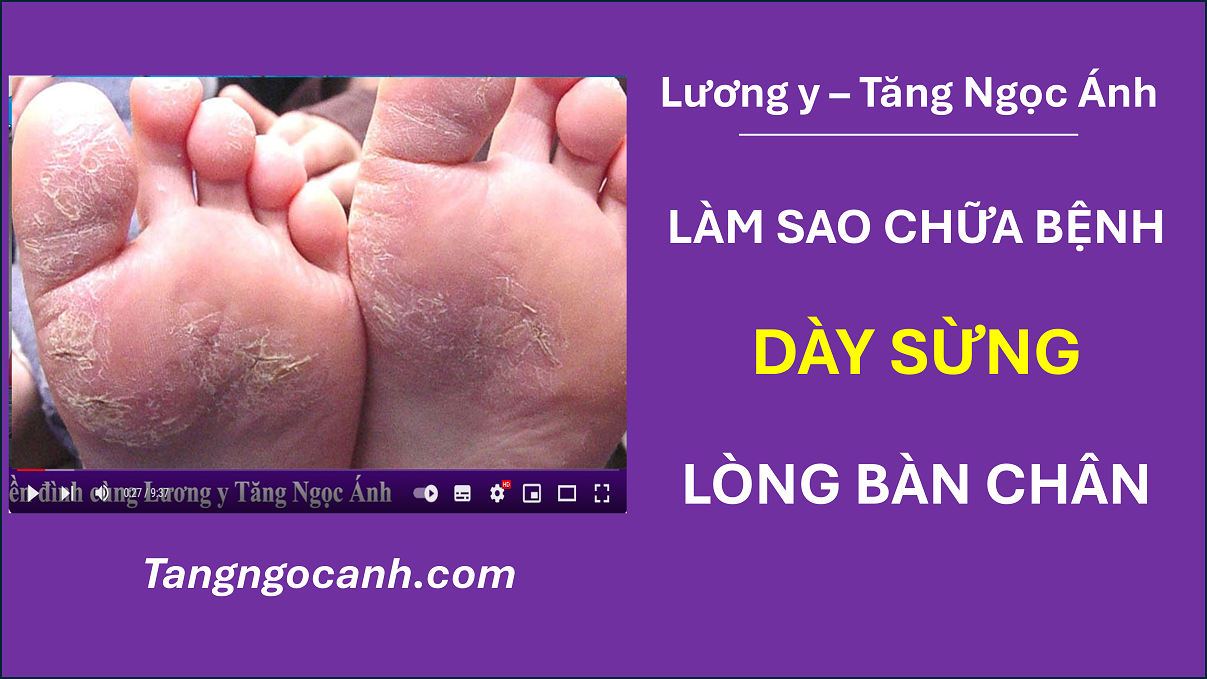 chữa da lòng bàn chân dày