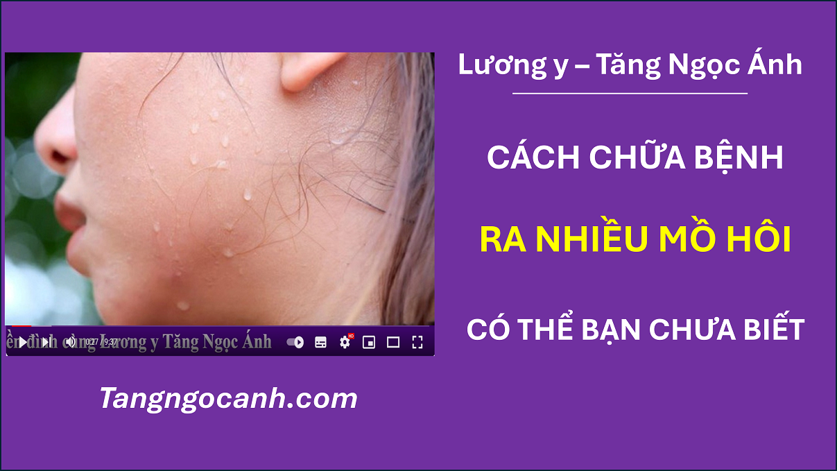 chữa bệnh ra nhiều mồ hôi