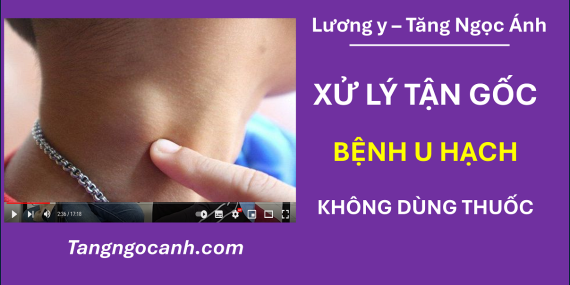 chữa bệnh hạch ở cổ