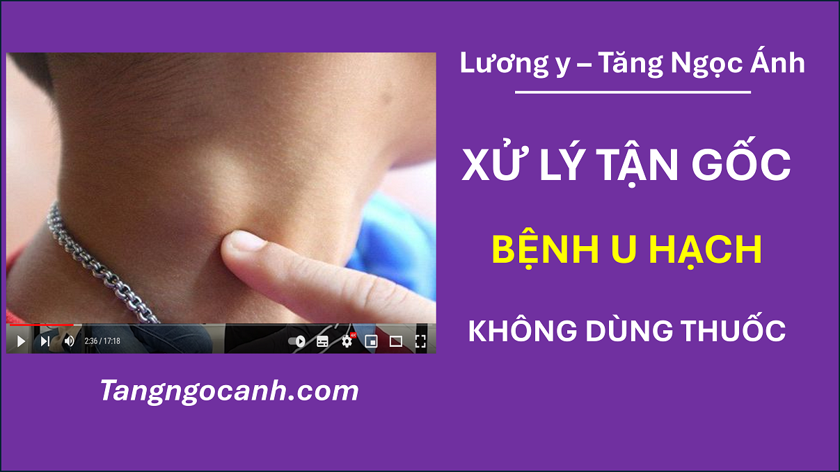 chữa bệnh hạch ở cổ
