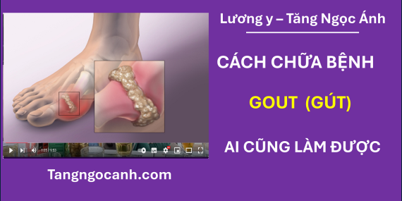 cách chữa bệnh gout ở chân