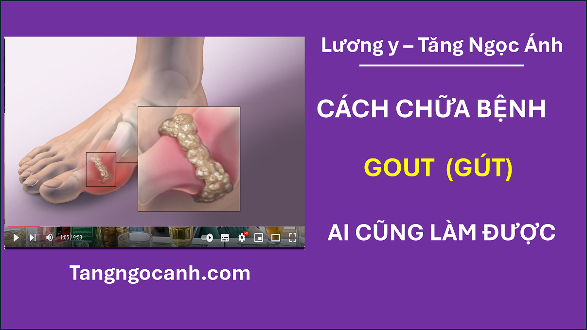 cách chữa bệnh gout ở chân