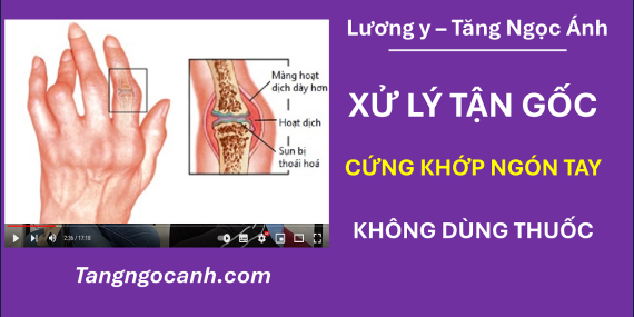 cách chữa cứng khớp ngón tay