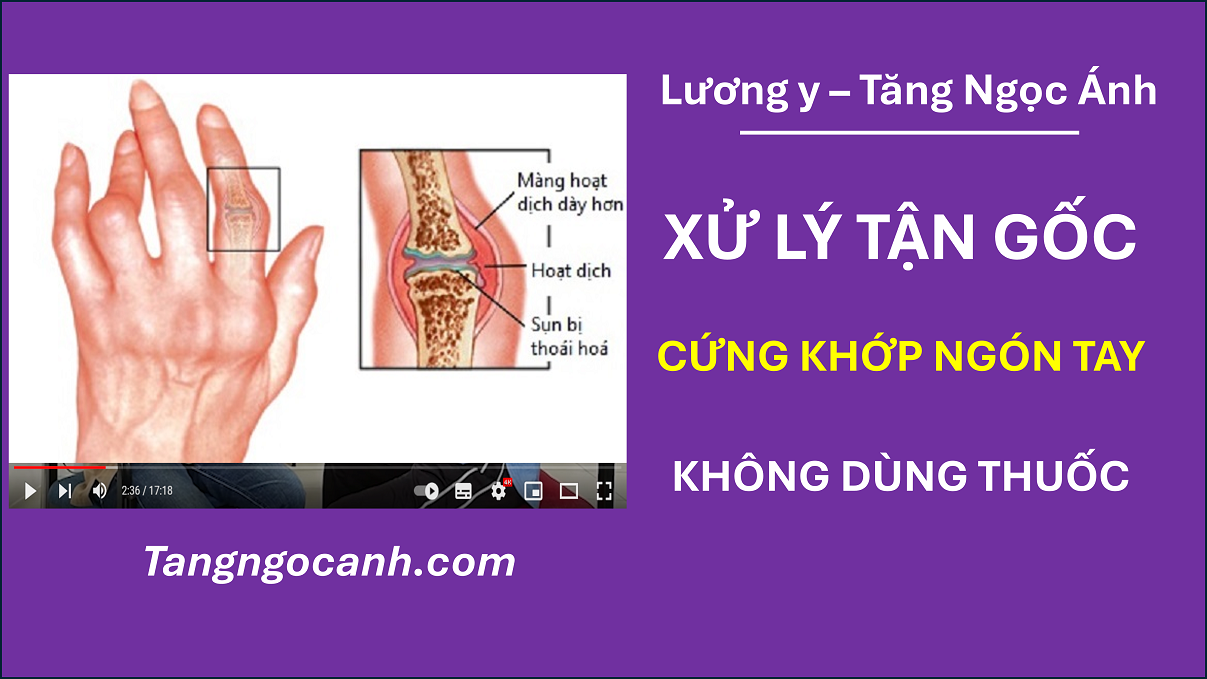 cách chữa cứng khớp ngón tay
