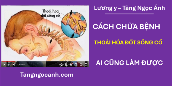 chữa thoái hóa đốt sống cổ