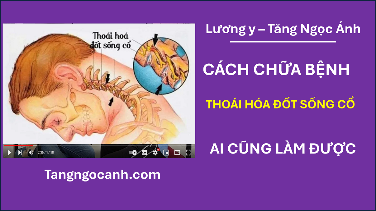 chữa thoái hóa đốt sống cổ