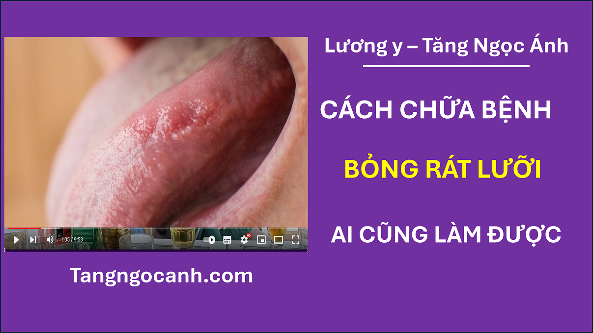 cách chữa bỏng rát lưỡi
