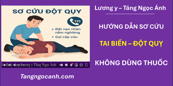 cách sơ cứu tai biến đột quỵ