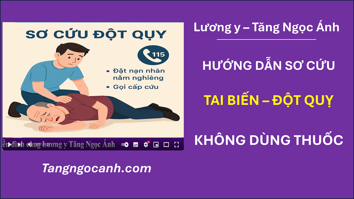 cách sơ cứu tai biến đột quỵ
