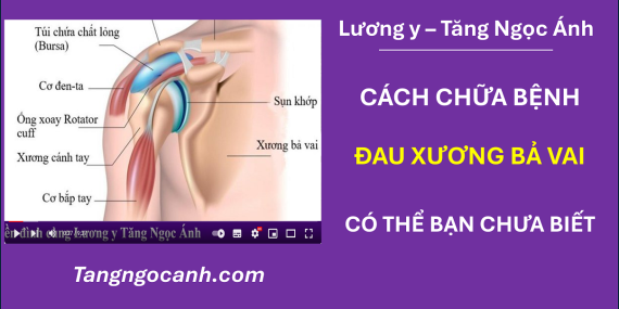 cách chữa đau xương bả vai