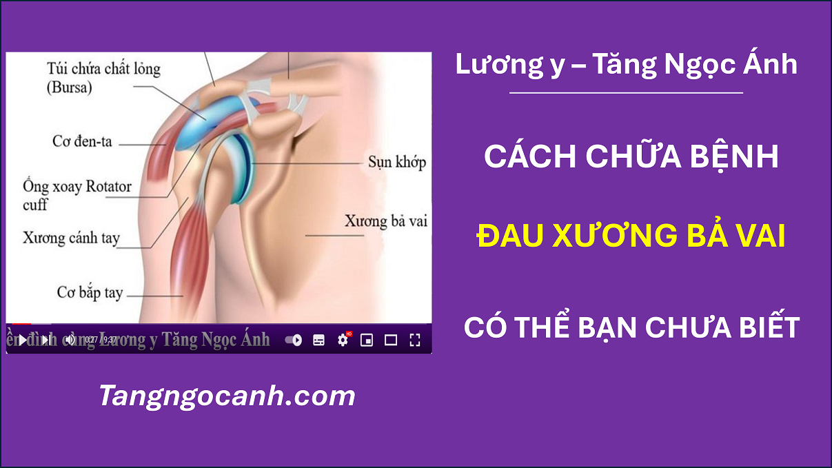 cách chữa đau xương bả vai